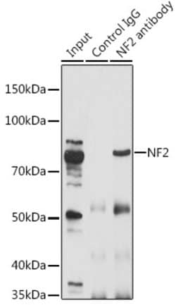 NF2 Polyclonal Antibody, Invitrogen 100 &mu;L; Unconjugated:Antibodies,