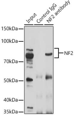 NF2 Polyclonal Antibody, Invitrogen 100 &mu;L; Unconjugated:Antibodies,