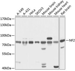 NF2 Polyclonal Antibody, Invitrogen 100 &mu;L; Unconjugated:Antibodies,