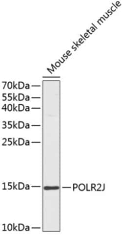 Invitrogen POLR2J Polyclonal Antibody 100 &mu;L; Unconjugated:Antibodies,