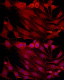 Invitrogen PSMB2 Polyclonal Antibody 100 &mu;L; Unconjugated:Antibodies,