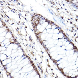 Invitrogen PSMB2 Polyclonal Antibody 100 &mu;L; Unconjugated:Antibodies,