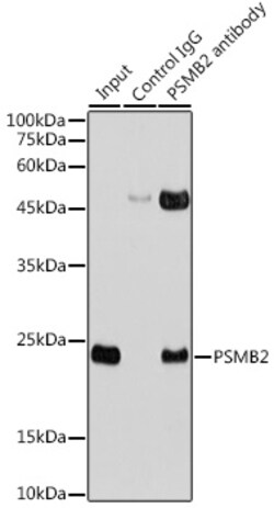 Invitrogen PSMB2 Polyclonal Antibody 100 &mu;L; Unconjugated:Antibodies,