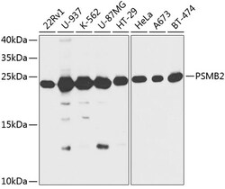 Invitrogen PSMB2 Polyclonal Antibody 100 &mu;L; Unconjugated:Antibodies,