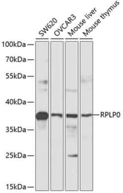 Invitrogen RPLP0 Polyclonal Antibody 100 &mu;L; Unconjugated:Antibodies,