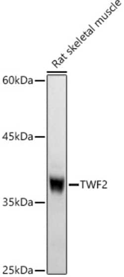 TWF2 Polyclonal Antibody, Invitrogen 100 &mu;L; Unconjugated:Antibodies,