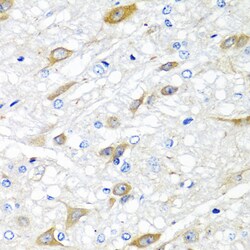 Invitrogen CPA6 Polyclonal Antibody 100 &mu;L; Unconjugated:Antibodies,