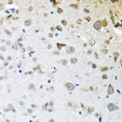 Invitrogen CPA6 Polyclonal Antibody 100 &mu;L; Unconjugated:Antibodies,