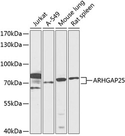 Invitrogen ARHGAP25 Polyclonal Antibody 100 &mu;L; Unconjugated:Antibodies,