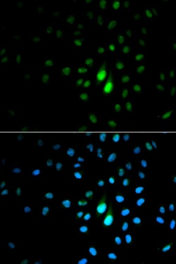 Invitrogen PIN1 Polyclonal Antibody 100 &mu;L | Buy Online | Invitrogen&trade; | Fisher Scientific