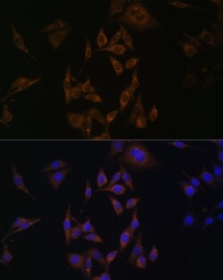 Invitrogen UBE2L6 Polyclonal Antibody 100 &mu;L; Unconjugated:Antibodies,