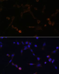 Invitrogen UBE2L6 Polyclonal Antibody 100 &mu;L; Unconjugated:Antibodies,