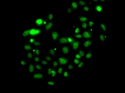 Invitrogen PMS2 Polyclonal Antibody 100 &mu;L; Unconjugated:Antibodies,