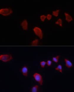 Invitrogen Carbonic Anhydrase IX Polyclonal Antibody 100 &mu;L; Unconjugated:Antibodies,