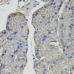 Invitrogen Carbonic Anhydrase IX Polyclonal Antibody 100 &mu;L; Unconjugated:Antibodies,