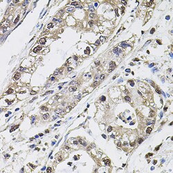 Invitrogen Carbonic Anhydrase IX Polyclonal Antibody 100 &mu;L; Unconjugated:Antibodies,