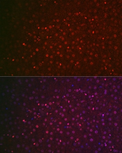 Invitrogen NR5A2 Polyclonal Antibody 100 &mu;L; Unconjugated:Antibodies,