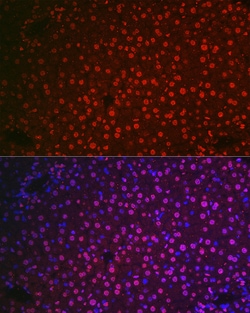 Invitrogen NR5A2 Polyclonal Antibody 100 &mu;L; Unconjugated:Antibodies,