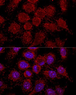 Invitrogen RPL30 Polyclonal Antibody 100 &mu;L; Unconjugated:Antibodies,