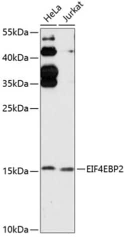 Invitrogen 4E-BP2 Polyclonal Antibody 100 &mu;L; Unconjugated:Antibodies,