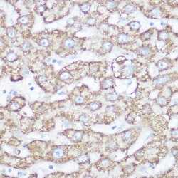 Invitrogen NDUFB7 Polyclonal Antibody 100 &mu;L; Unconjugated:Antibodies,