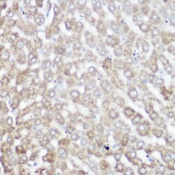 Invitrogen NDUFB7 Polyclonal Antibody 100 &mu;L; Unconjugated:Antibodies,