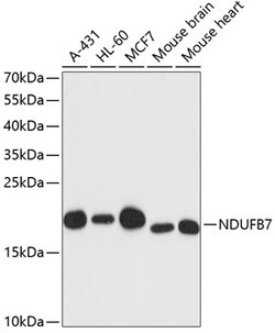 Invitrogen NDUFB7 Polyclonal Antibody 100 &mu;L; Unconjugated:Antibodies,