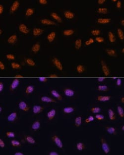 Invitrogen SARNP Polyclonal Antibody 100 &mu;L; Unconjugated:Antibodies,
