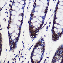 Invitrogen SARNP Polyclonal Antibody 100 &mu;L; Unconjugated:Antibodies,