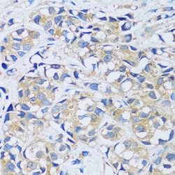 Invitrogen CABP7 Polyclonal Antibody 100 &mu;L; Unconjugated:Antibodies,