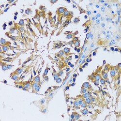 Invitrogen CABP7 Polyclonal Antibody 100 &mu;L; Unconjugated:Antibodies,