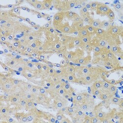 Invitrogen CABP7 Polyclonal Antibody 100 &mu;L; Unconjugated:Antibodies,