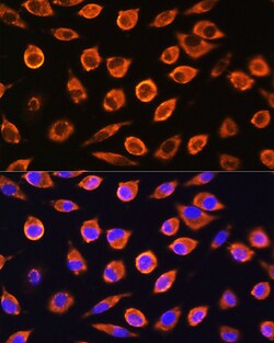 Invitrogen RND1 Polyclonal Antibody 100 &mu;L; Unconjugated:Antibodies,