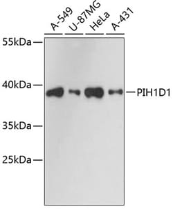 Invitrogen PIH1D1 Polyclonal Antibody 100 &mu;L; Unconjugated:Antibodies,