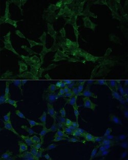 Invitrogen CAMLG Polyclonal Antibody 100 &mu;L; Unconjugated:Antibodies,