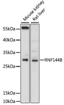 RNF144B Polyclonal Antibody, Invitrogen 100 &mu;L; Unconjugated:Antibodies,