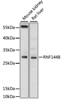 RNF144B Polyclonal Antibody, Invitrogen 100 &mu;L; Unconjugated:Antibodies,