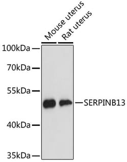 Invitrogen SERPINB13 Polyclonal Antibody 100 &mu;L; Unconjugated:Antibodies,