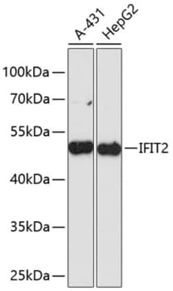 Invitrogen IFIT2 Polyclonal Antibody 100 &mu;L; Unconjugated:Antibodies,