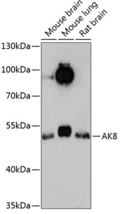 Invitrogen Adenylate Kinase 8 Polyclonal Antibody 100 &mu;L | Buy Online | Invitrogen&trade; | Fisher Scientific