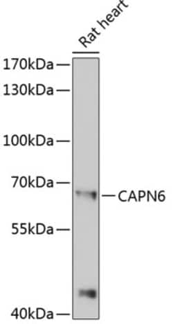 Invitrogen Calpain 6 Polyclonal Antibody 100 &mu;L; Unconjugated:Antibodies,