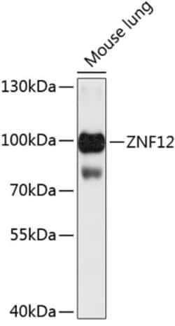 Invitrogen ZNF12 Polyclonal Antibody 100 &mu;L; Unconjugated:Antibodies,