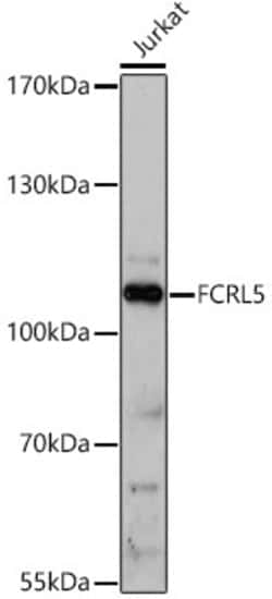 Invitrogen FcRL5 Polyclonal Antibody 100 &mu;L | Buy Online | Invitrogen&trade; | Fisher Scientific