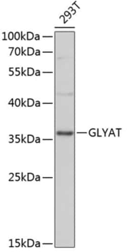 Invitrogen GLYAT Polyclonal Antibody 100 &mu;L; Unconjugated:Antibodies,