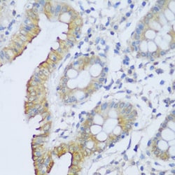 Invitrogen EFCAB4B Polyclonal Antibody 100 &mu;L; Unconjugated:Antibodies,