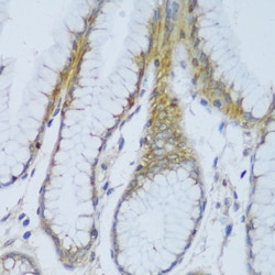 Invitrogen EFCAB4B Polyclonal Antibody 100 &mu;L; Unconjugated:Antibodies,