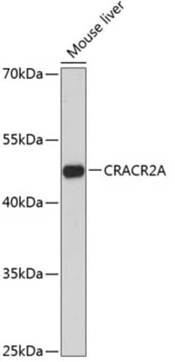 Invitrogen EFCAB4B Polyclonal Antibody 100 &mu;L; Unconjugated:Antibodies,