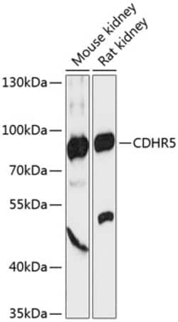 Invitrogen CDHR5 Polyclonal Antibody 100 &mu;L; Unconjugated:Antibodies,