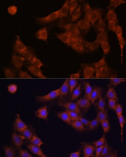 Invitrogen GANAB Polyclonal Antibody 100 &mu;L; Unconjugated:Antibodies,