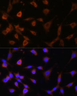Invitrogen GANAB Polyclonal Antibody 100 &mu;L; Unconjugated:Antibodies,